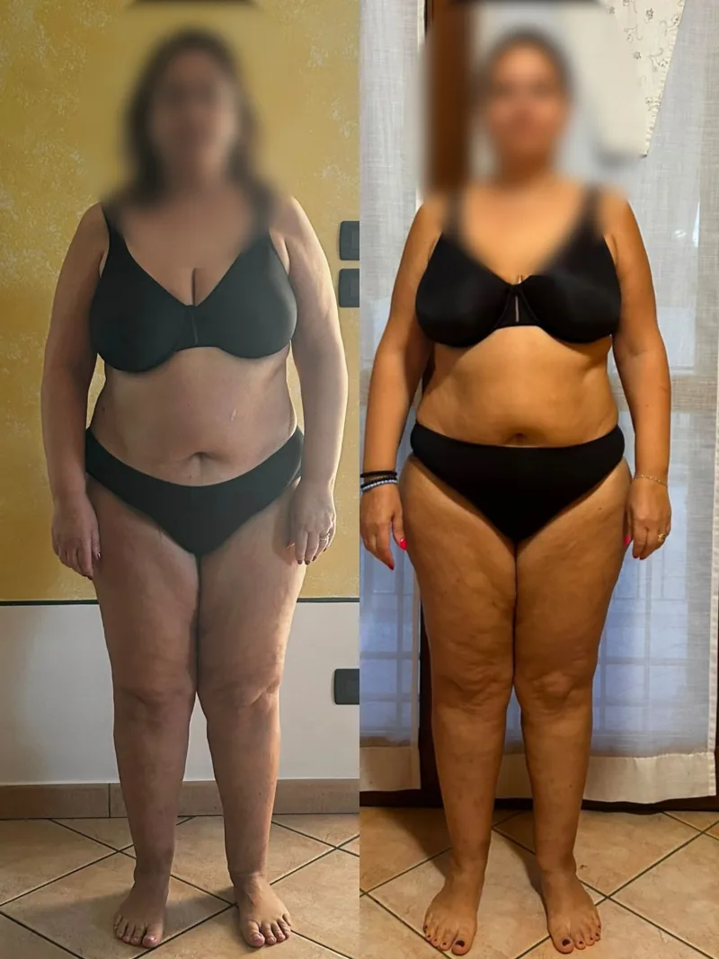 Prima e dopo, fronte