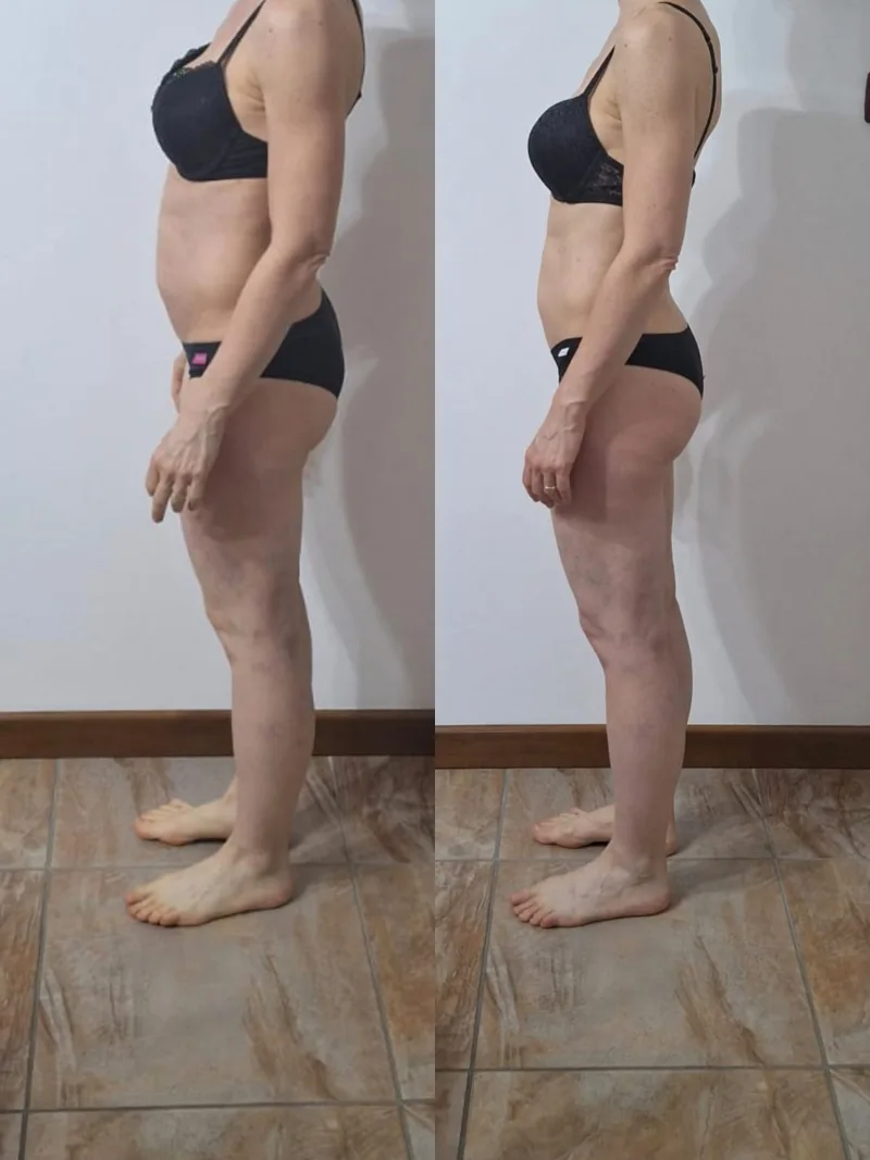 Prima e dopo, profilo