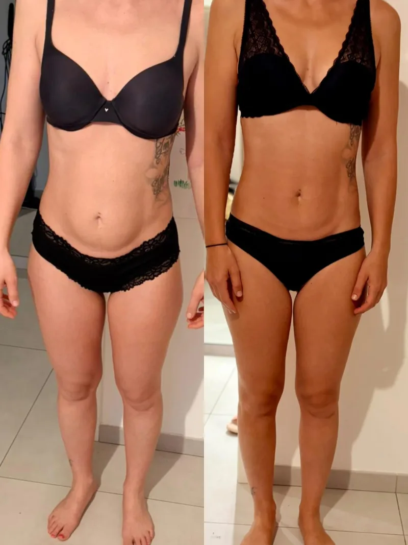 Prima e dopo, fronte